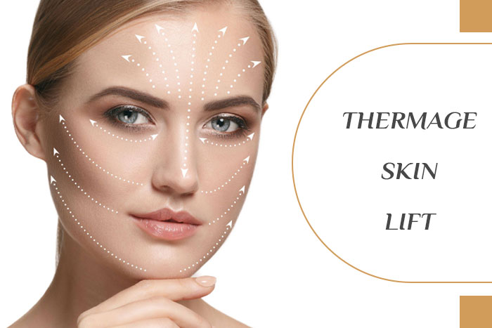 Thermage Skin Lift